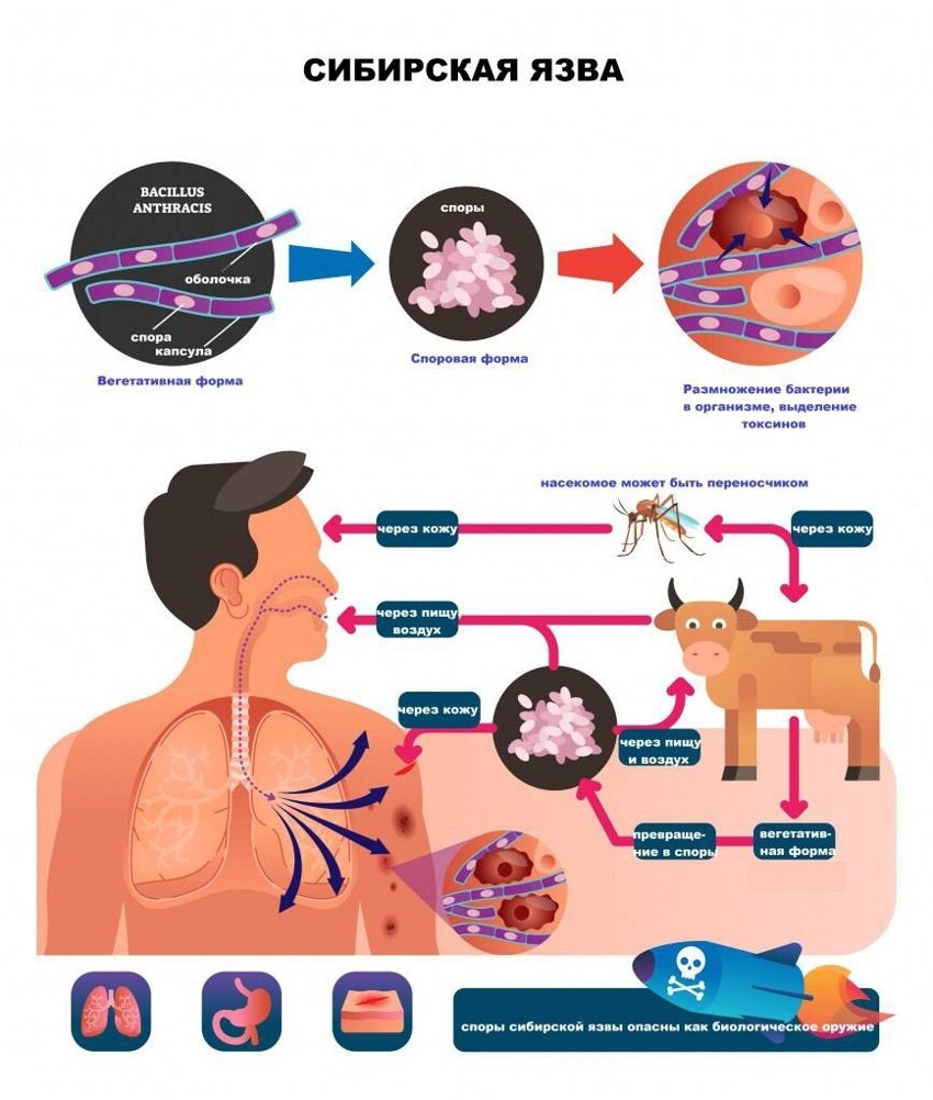 Сибирская язва. Памятка населению.